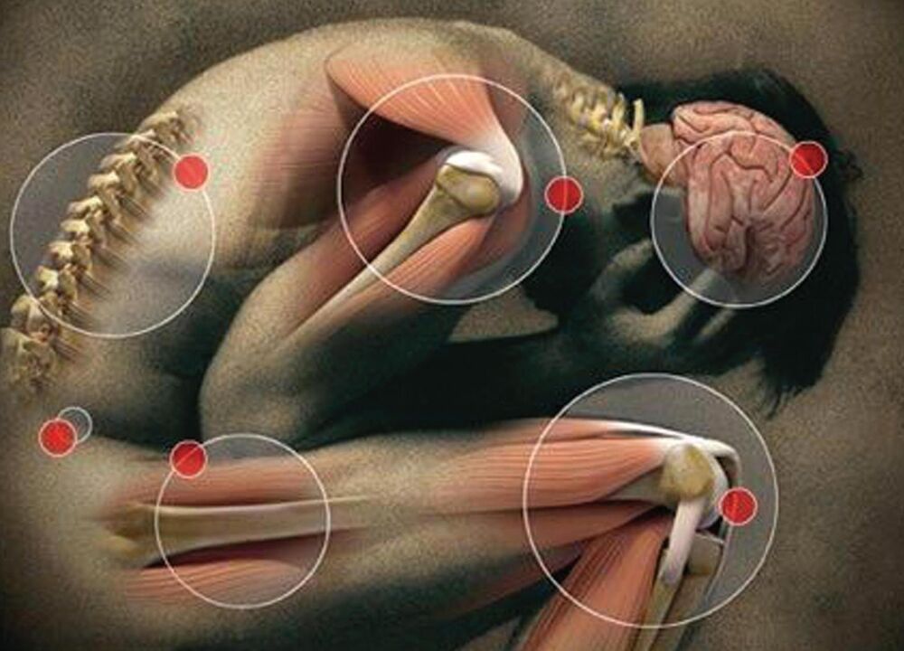 Articulations du corps touchées par l'arthrose